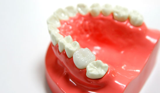 大野歯科の治療の説明「ジルコニアセラミック」