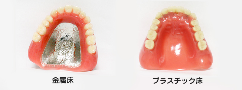 大野歯科の入れ歯の説明