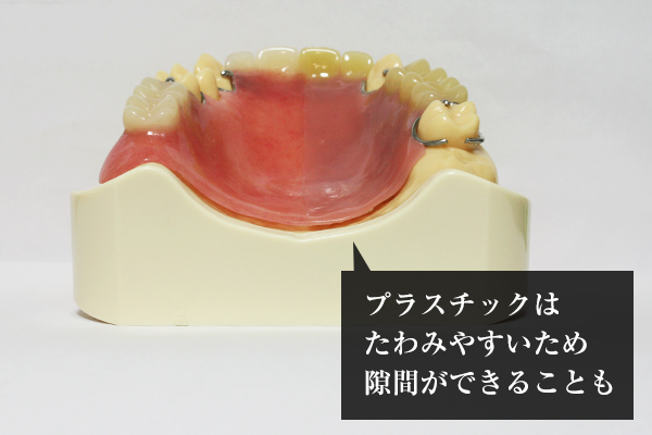 大野歯科の入れ歯についての説明「安定性(よく噛める)」