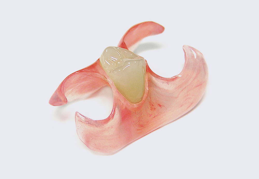 大野歯科のスマイルデンチャー