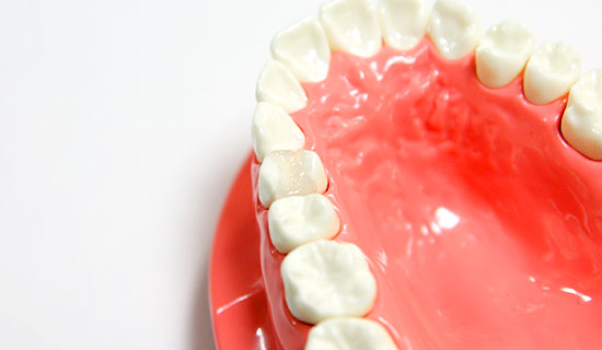 大野歯科の治療メニュー「オールセラミック」