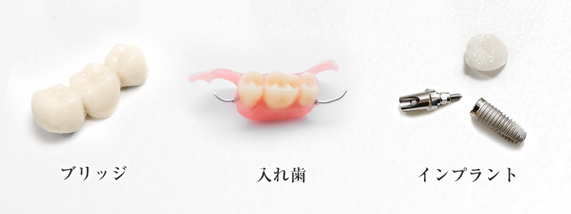 大野歯科の失った歯を補う治療の説明